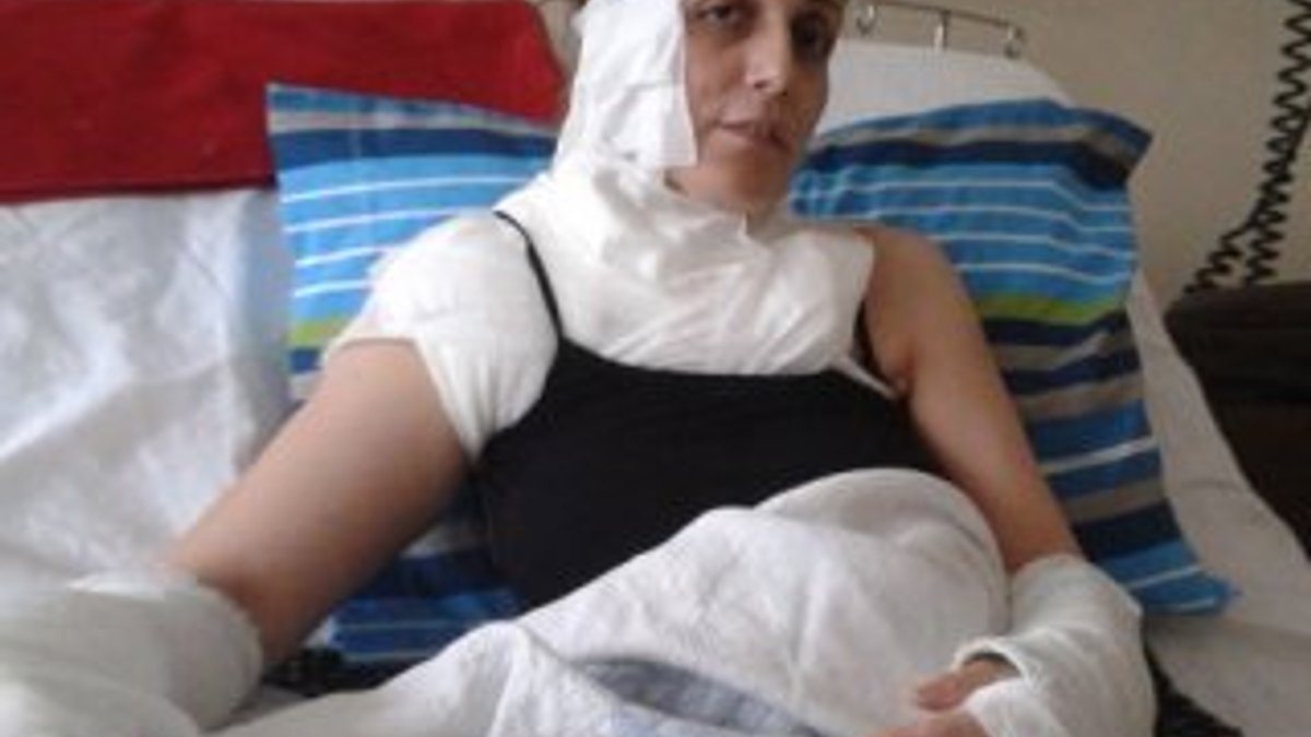 Bolu'da bir kadın lavabo açıcının patlaması sonucu yandı