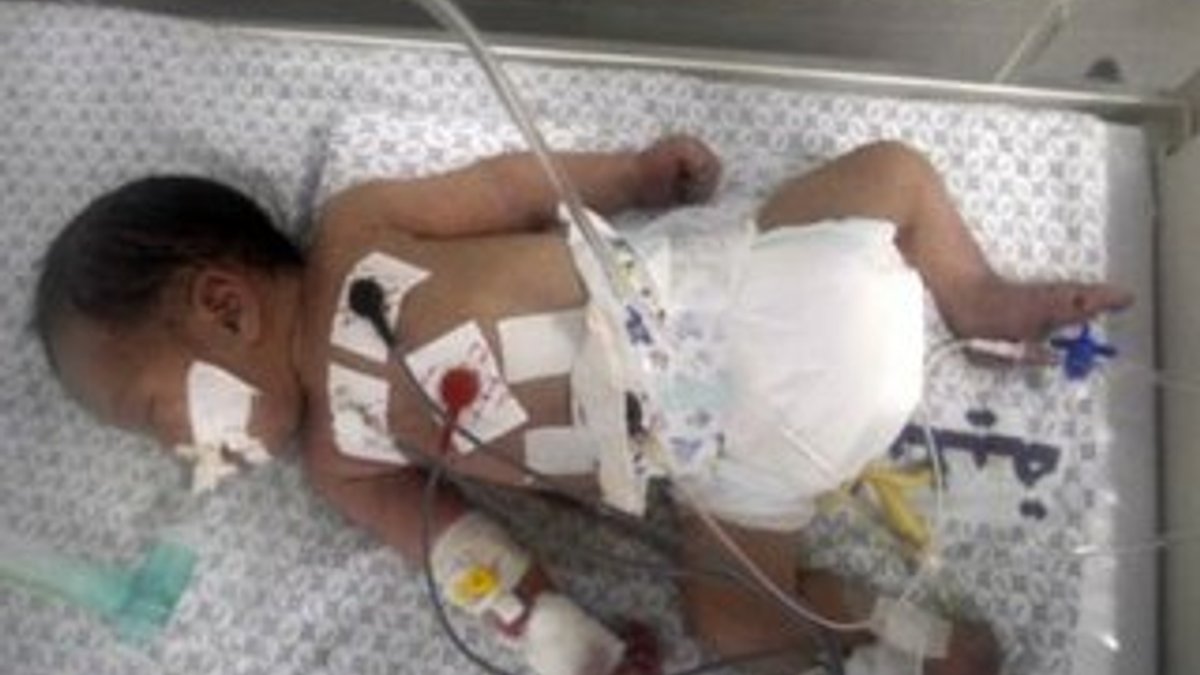 Gazzeli minik Şeyma bebek hayatını kaybetti İZLE