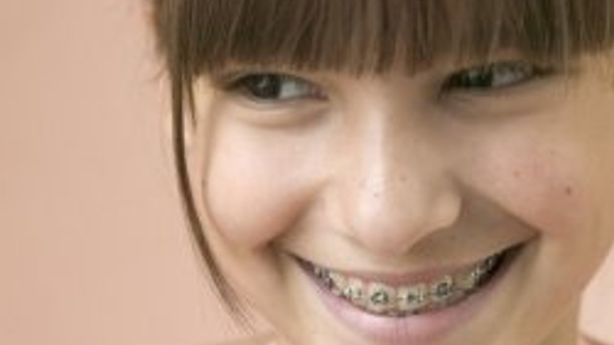 Ortodontik tedavi ile bir ömür boyu düzgün dişler