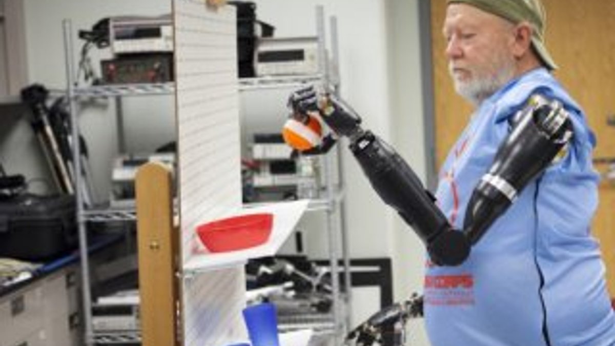 ABD'de kolları olmayan adama robot protez takıldı