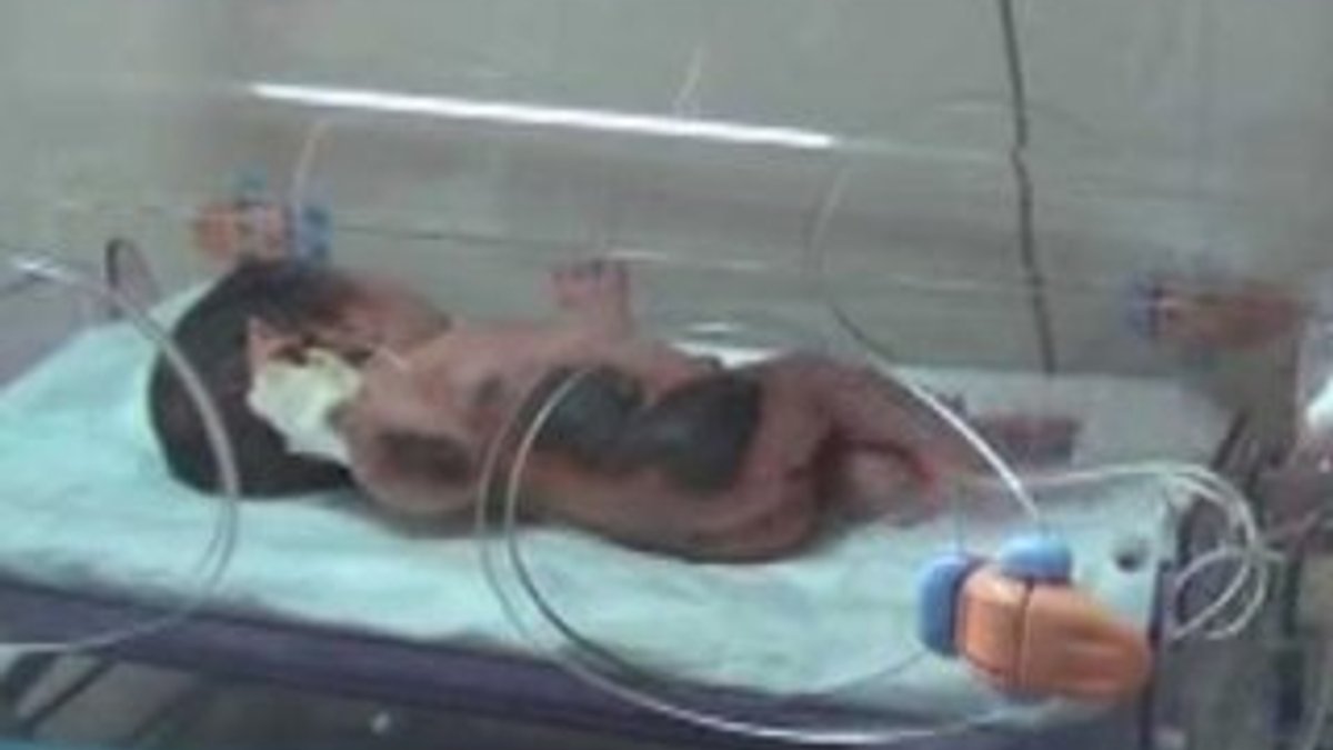 Siirt'te yeni doğan bebeği ısıtıcıda unuttular