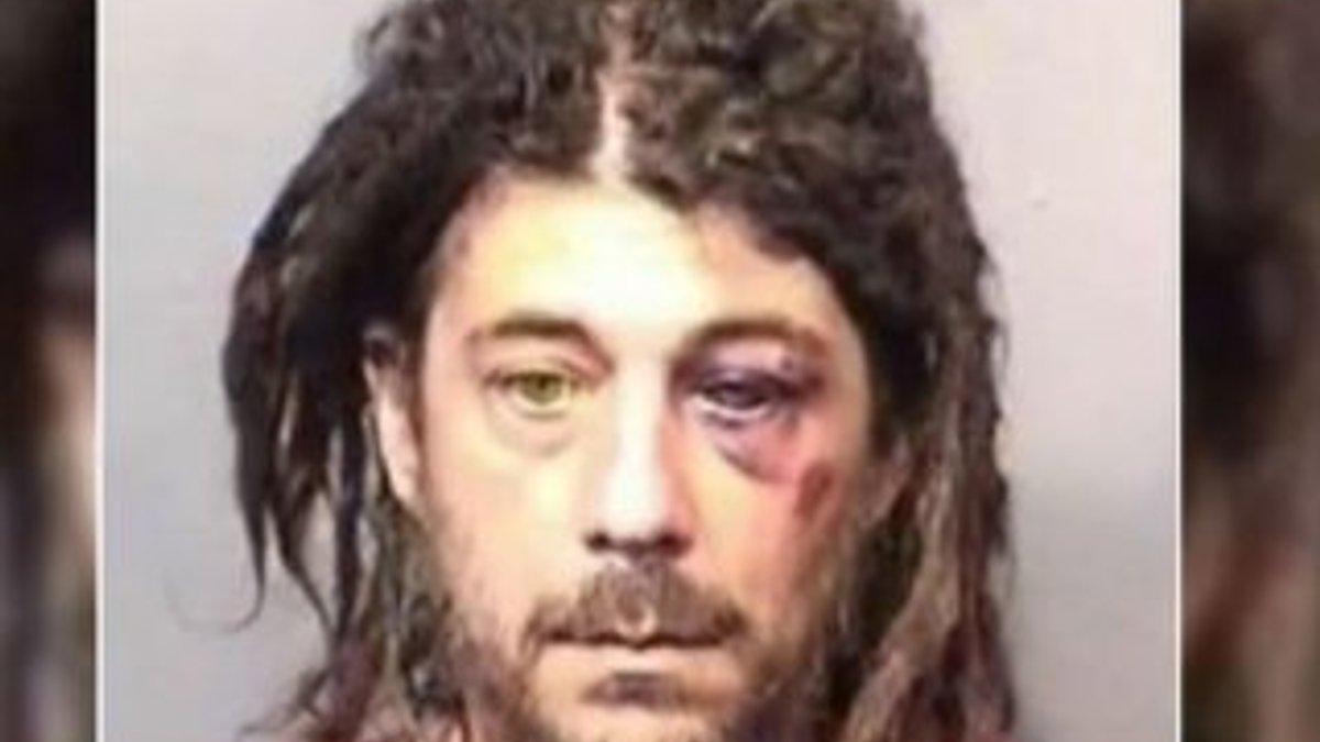ABD'de ağaçla seks yapan adam polise saldırdı