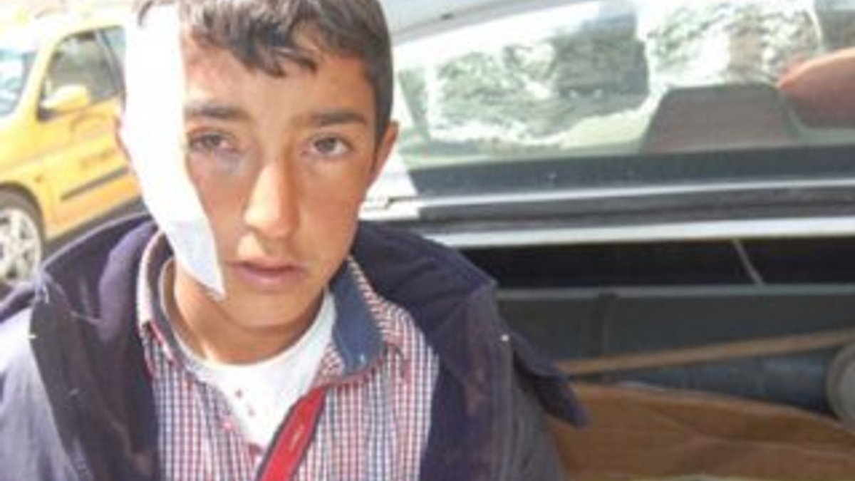 Bitlis'te eve giren porsuk çocuklara saldırdı