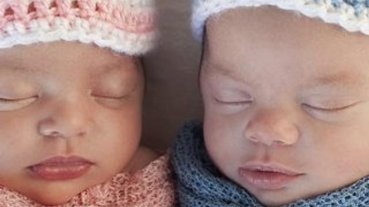 ABD'de ikiz bebeklerin babaları farklı çıktı