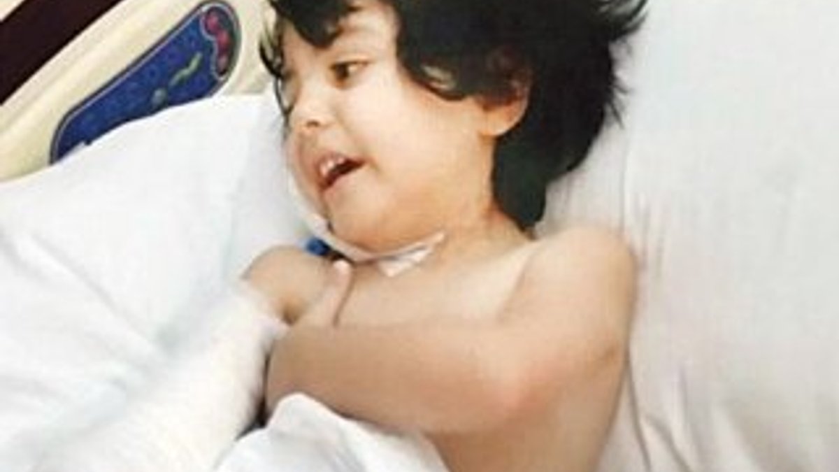Yozgat'ta yanlış tedavi edilen bebeğin kolu kesildi