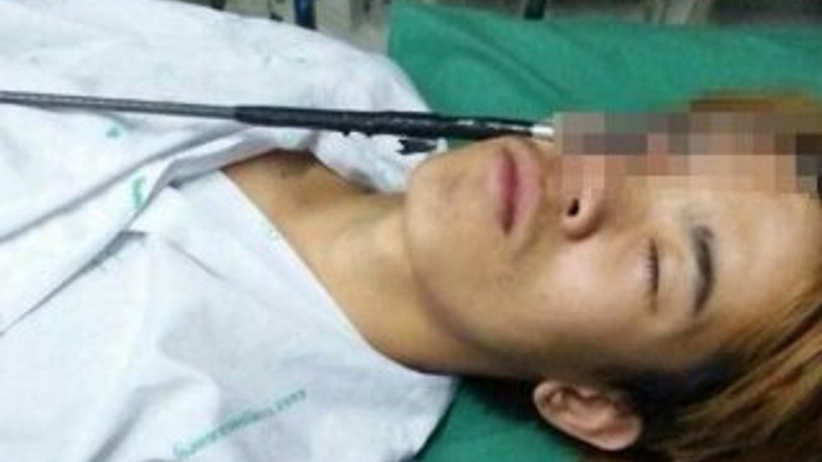 Taylandlı genç zıpkınla kendini gözünden vurdu