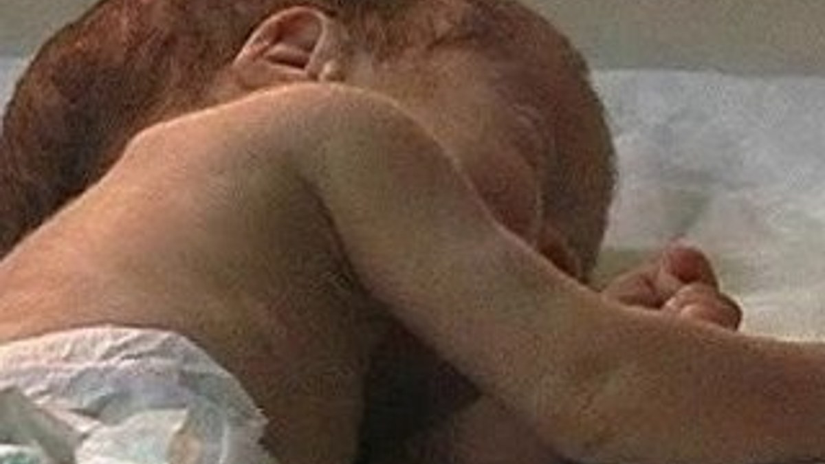 Şanlıurfa'da anne karnındaki bebeğe kan nakli yapıldı