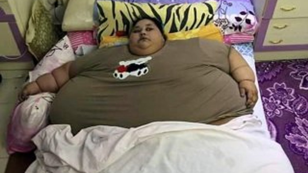 Dünyanın yaşayan en kilolu kadını: Tam yarım ton