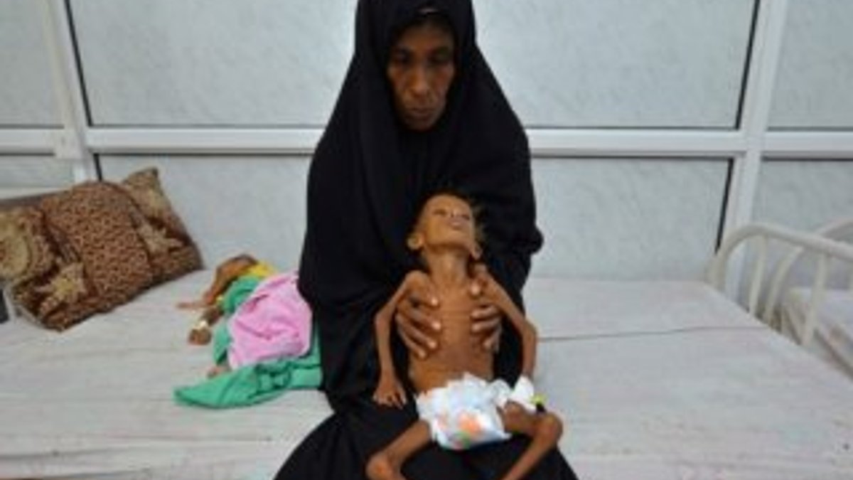 Yemen'de binlerce çocuk açlığın pençesinde