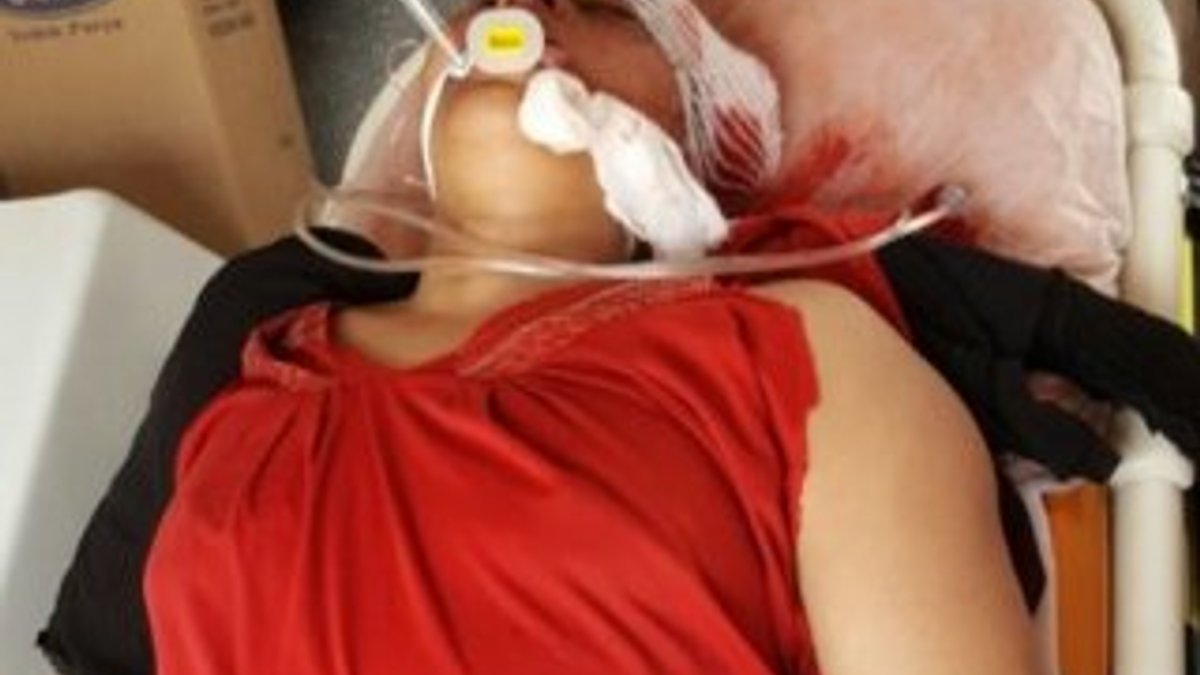 PYD'li teröristler Suriye'de sivil kadına saldırdı