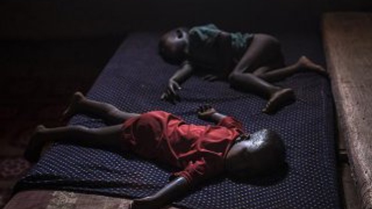 Somali'de kolera 700 kişinin ölümüne neden oldu