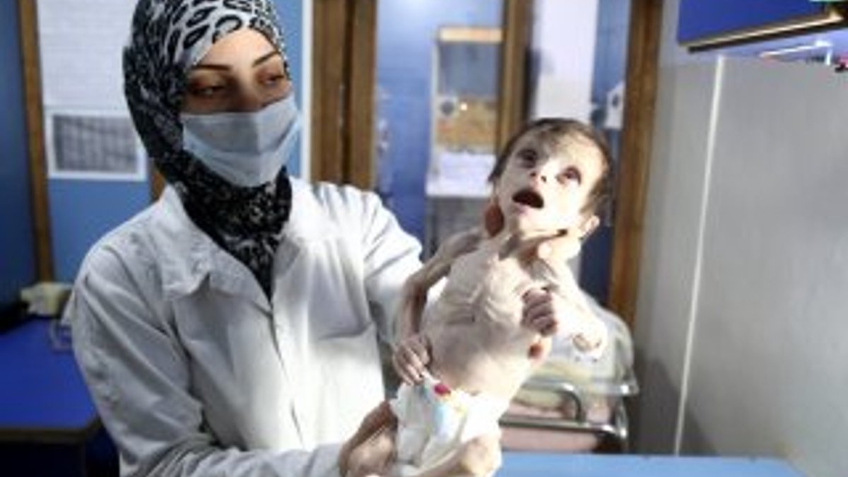 Suriyeli bebekler yetersiz beslenmekten ölüyor
