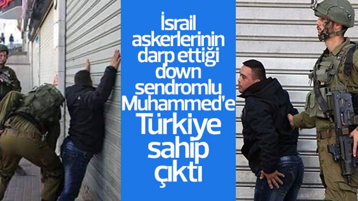 Down sendromlu Muhammed'e Türkiye sahip çıktı