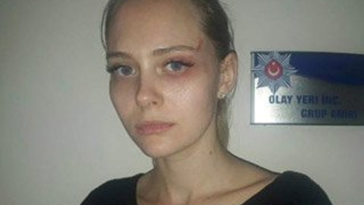 Ukraynalı mankenden tecavüz ve darp iddiası