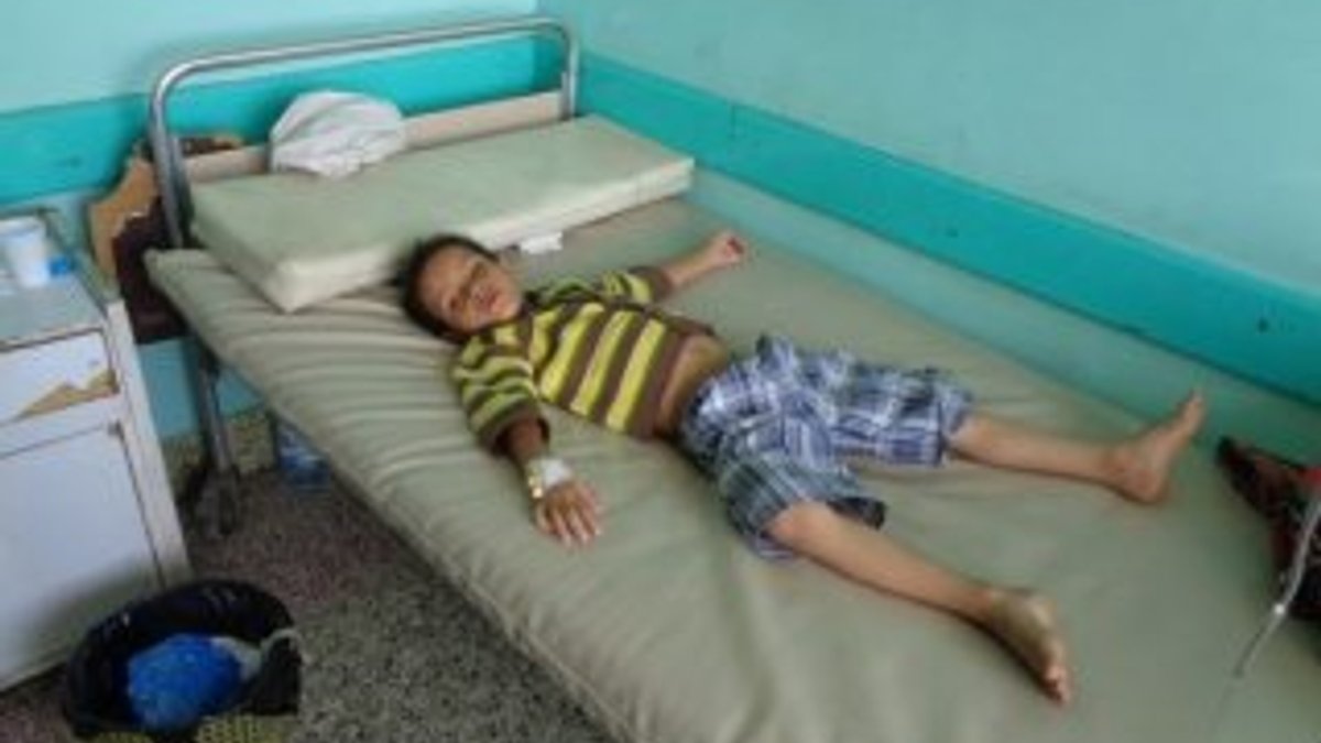 Yemen'de difteriden ölenlerin sayısı 72'ye çıktı
