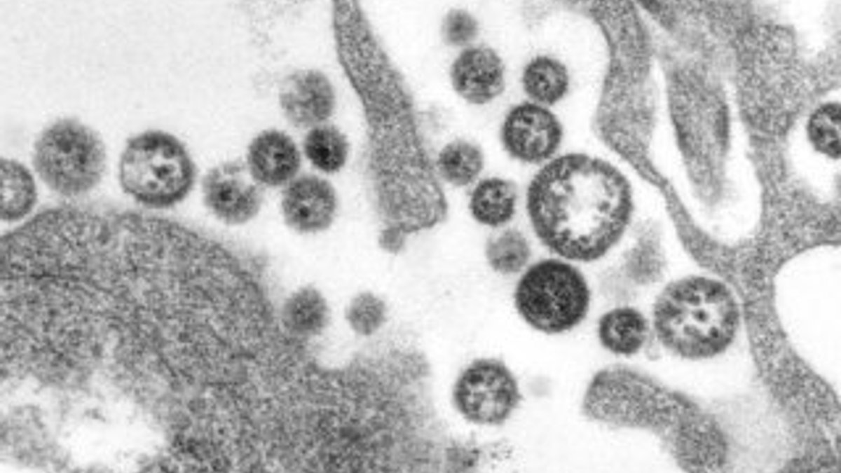 Ölümcül 'Lassa Humması'na aşı bulunamıyor