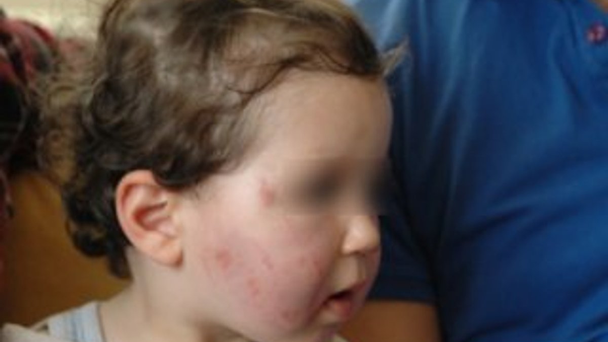 Kreşte 1,5 yaşındaki bebeğin dövüldüğü iddiası