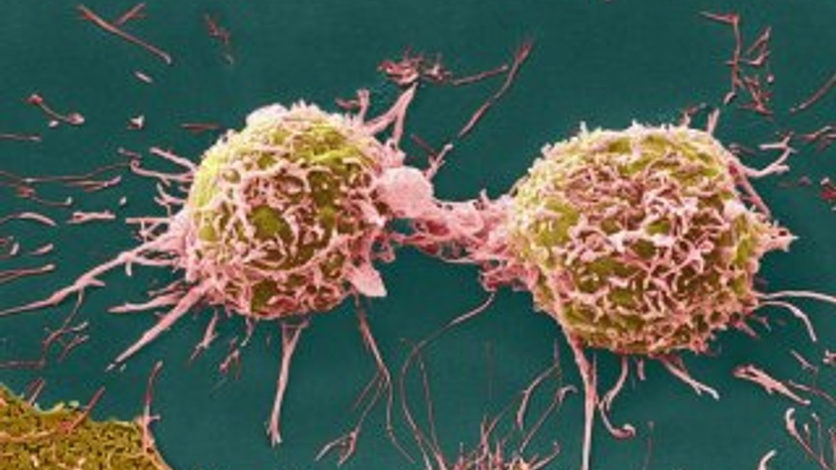 Kanserli hücrelerin çoğalmasını önleyen madde bulundu