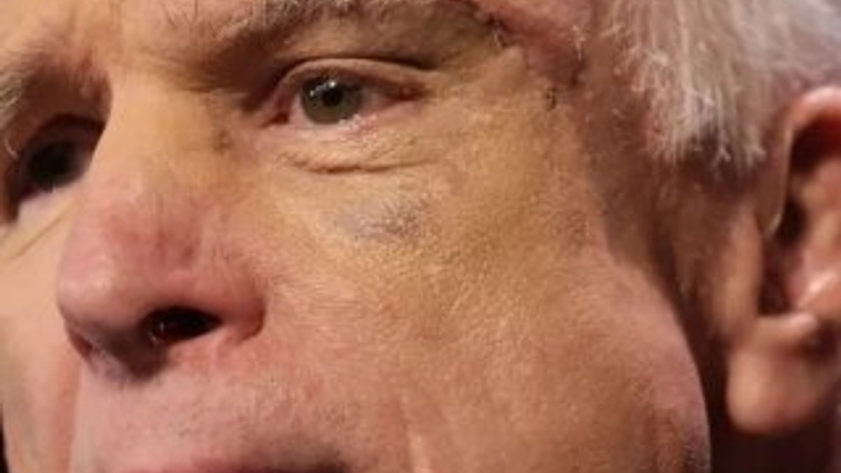ABD’li senatör McCain, beyin tümörü tedavisini durdurdu