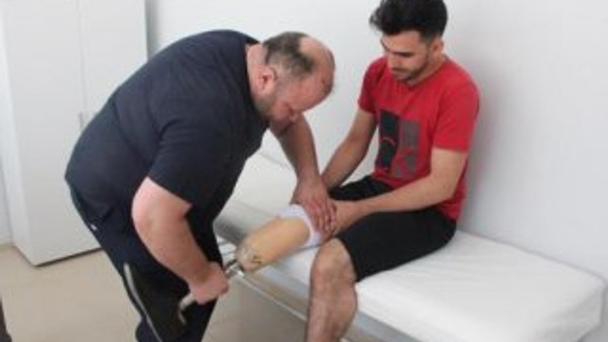 Şanlıurfa'da 590 Suriyeliye protez bacak takıldı
