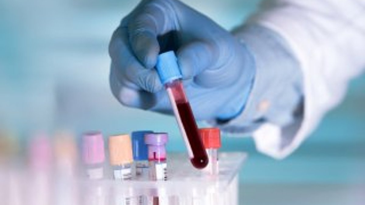 Bilim insanları, tek kan testiyle 20 kanser türü tespit etti