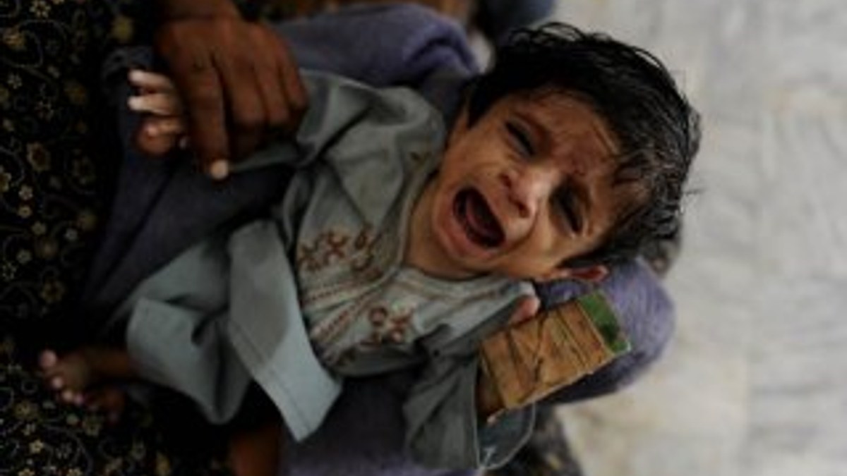 Pakistan'da tek kentte 10 ayda 703 çocuk açlıktan öldü