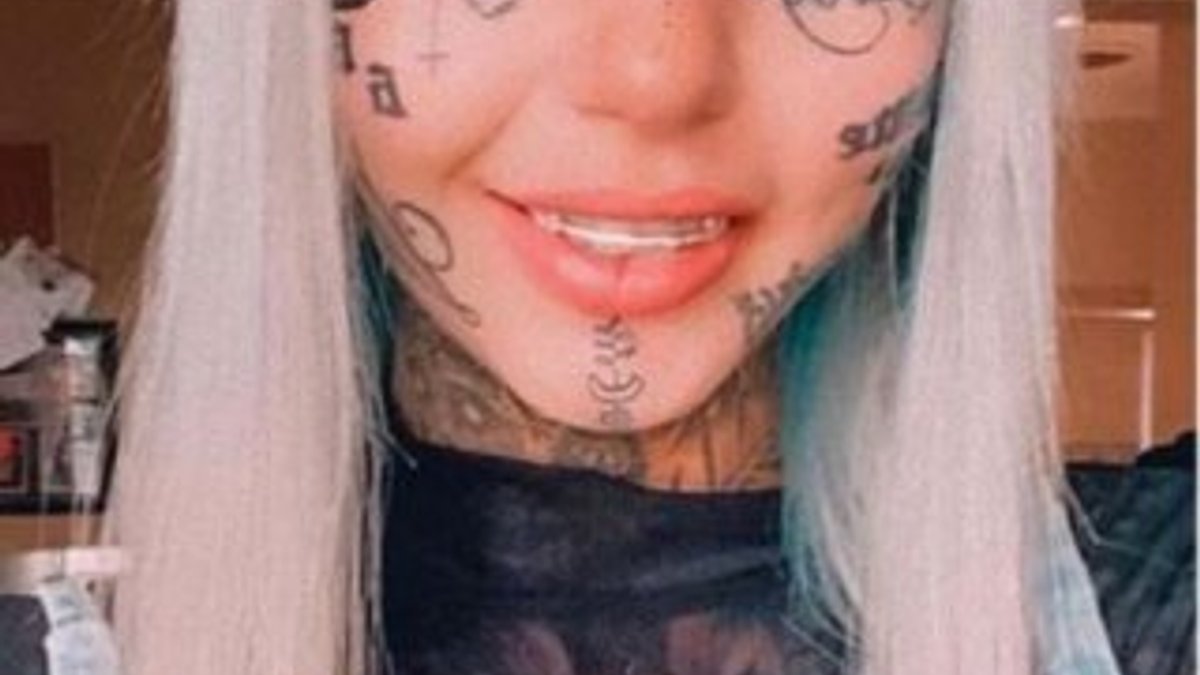 Avustralya'da gözüne dövme yaptıran genç kız kör oluyordu