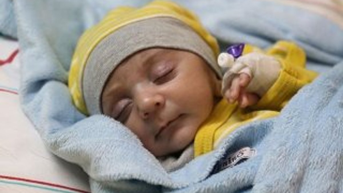 'Yaşamaz' denilen Ömer bebek yaşam savaşını kazandı