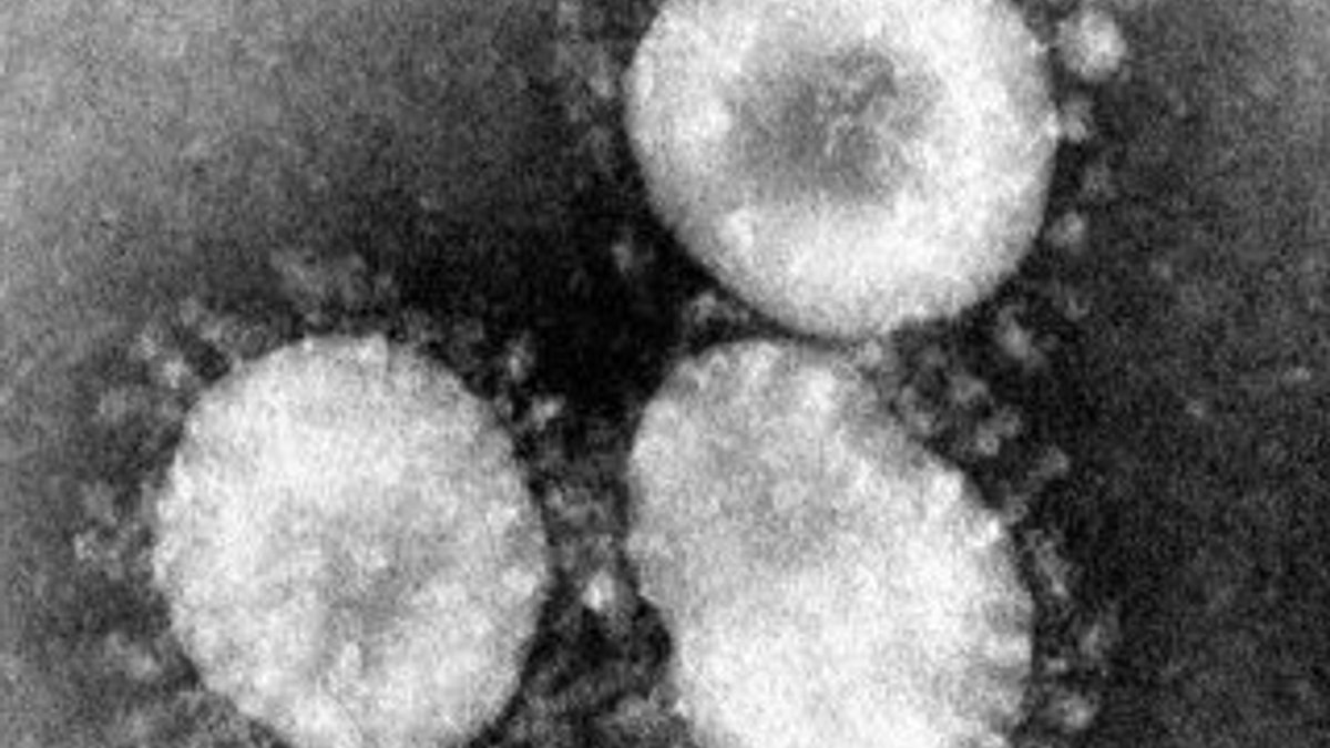 Çin'de SARS'a benzeyen gizemli virüs öldürdü