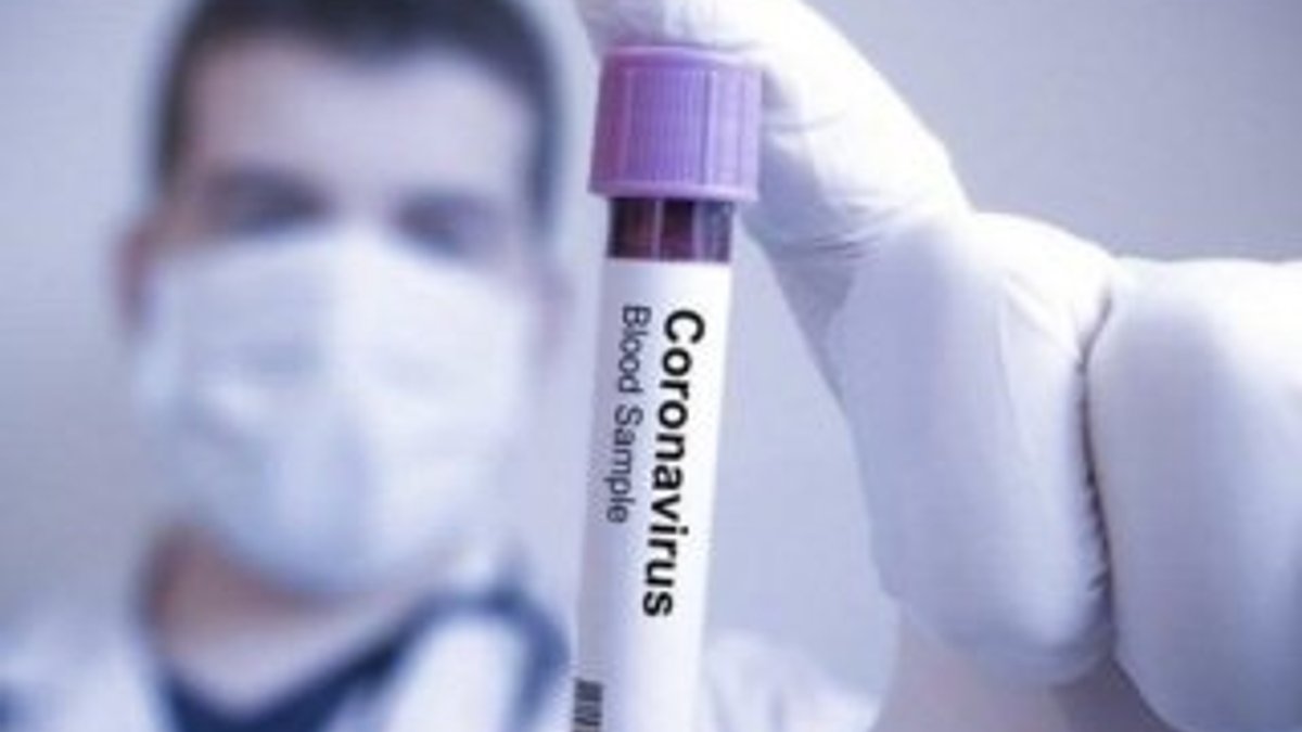 Koronavirüs aşısı 8 - 10 ay içinde geliştirilebilir