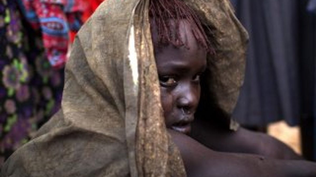 Dünya genelinde 200 milyon kadın sünnetli