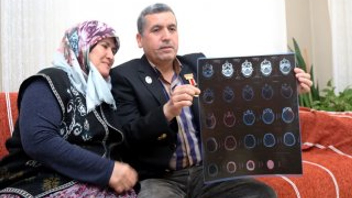 Gazi, 28 yıldır başındaki 14 şarapnel parçasıyla yaşıyor