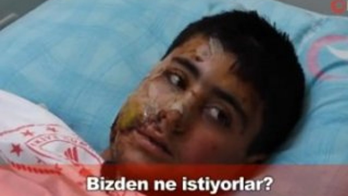 PKK bombasıyla yaralanan Suriyeli çocuk: Bizden ne istiyorlar