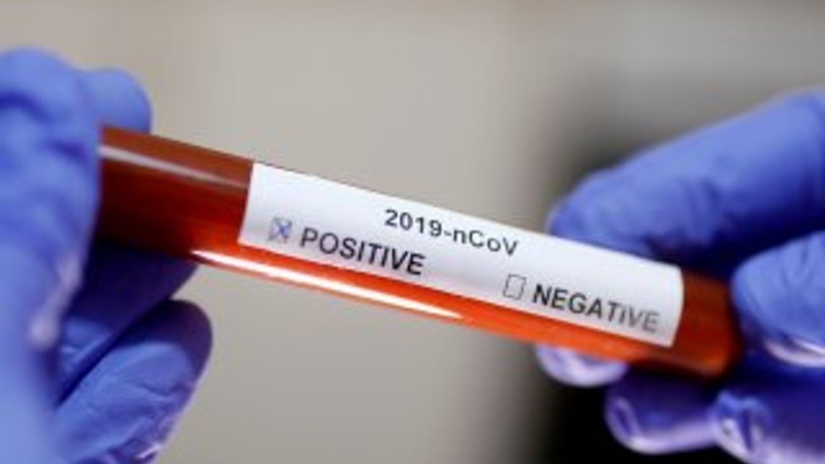 Arnavutluk'ta koronavirüs nedeniyle ilk ölüm