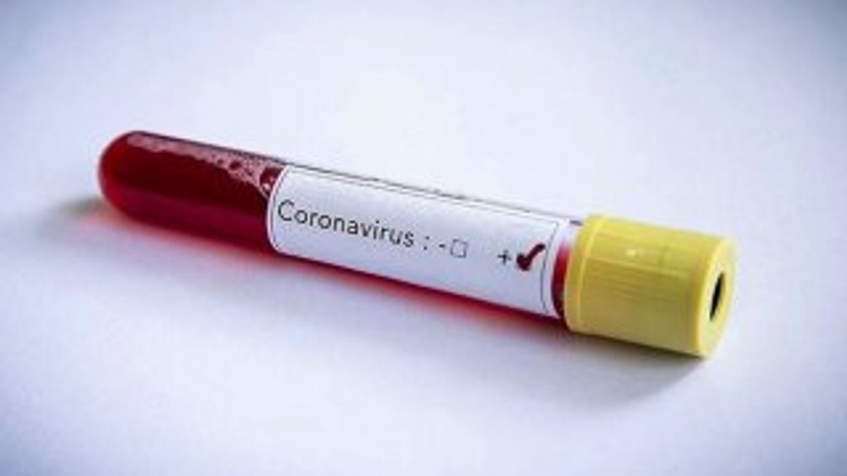 ABD'li genç sigortası olmadığı için koronavirüsten öldü