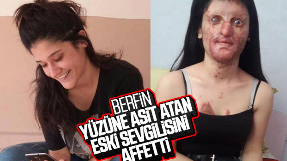 Berfin Özek, asitli saldırganı hala sevdiğini açıkladı
