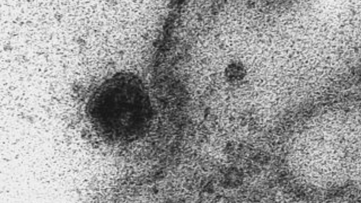 Koronavirüsün sağlıklı hücrelere saldırma anı