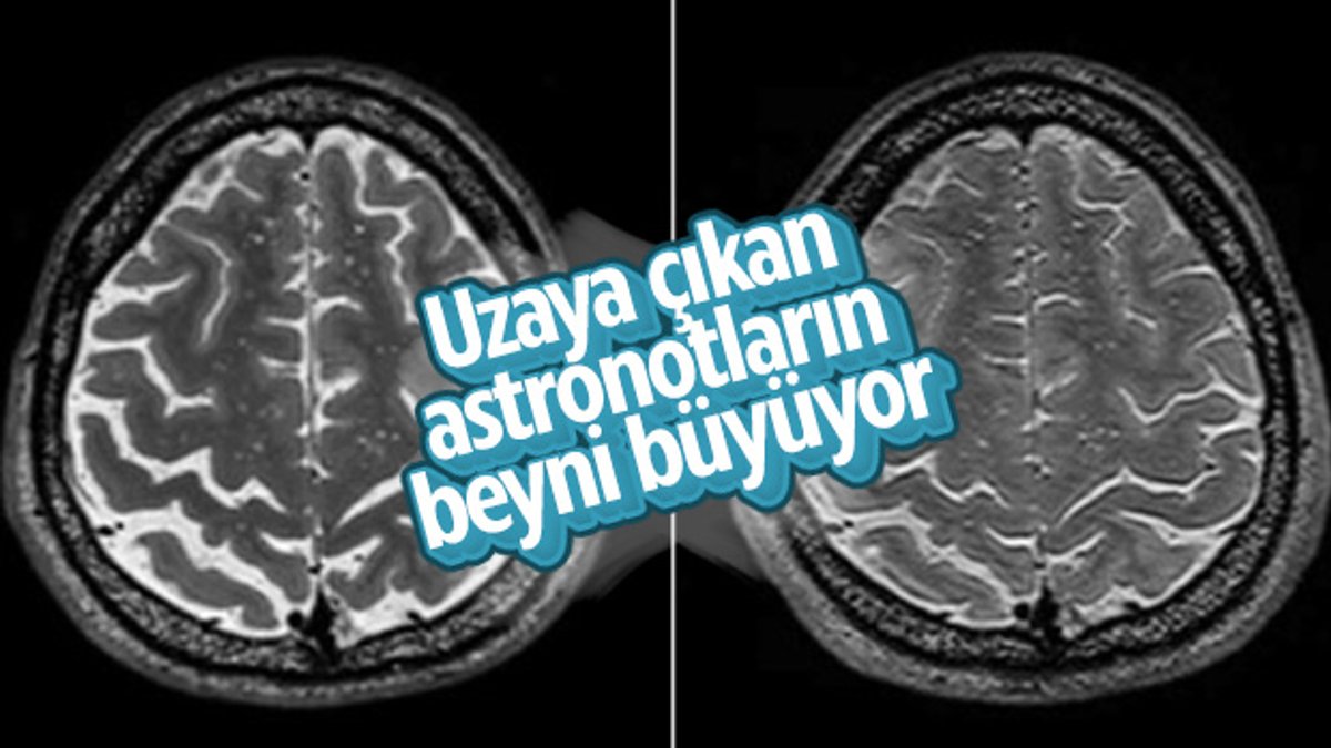 Uzayda yaşamanın insan beynini büyüttüğü ortaya çıktı