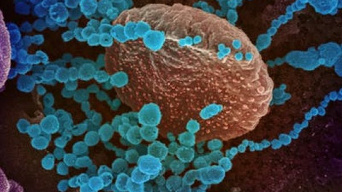 Koronavirüs, belirli hücreleri hedef alıyor