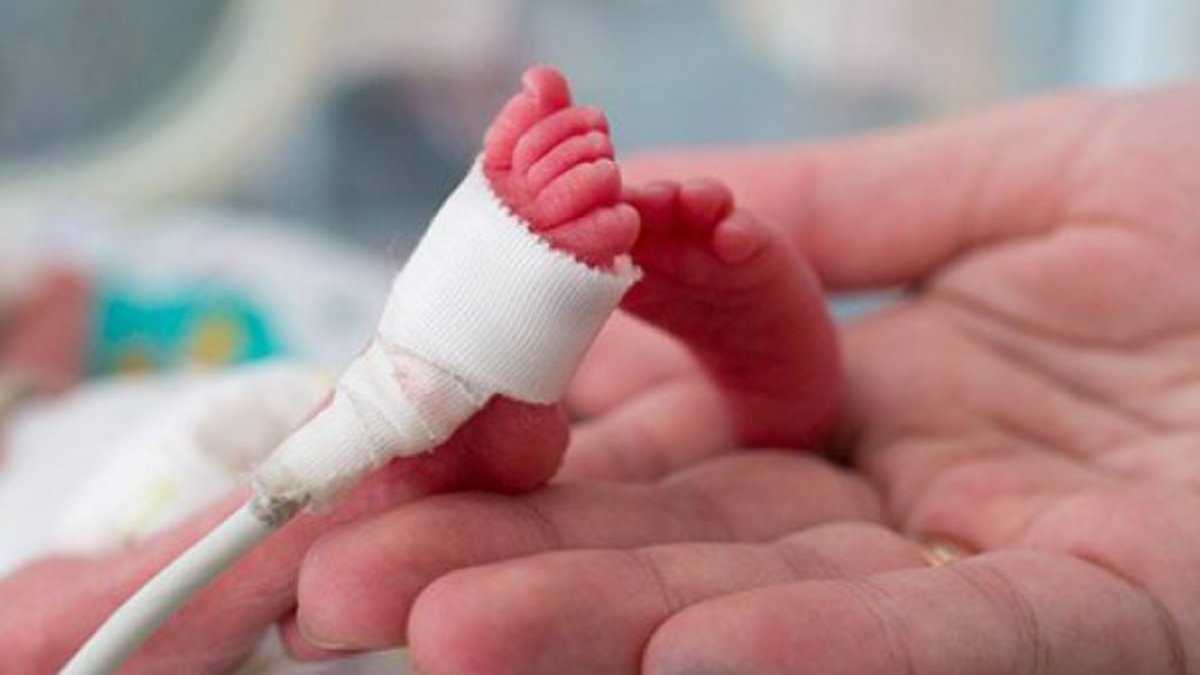 İran'da premature doğan bebek koronayı yendi