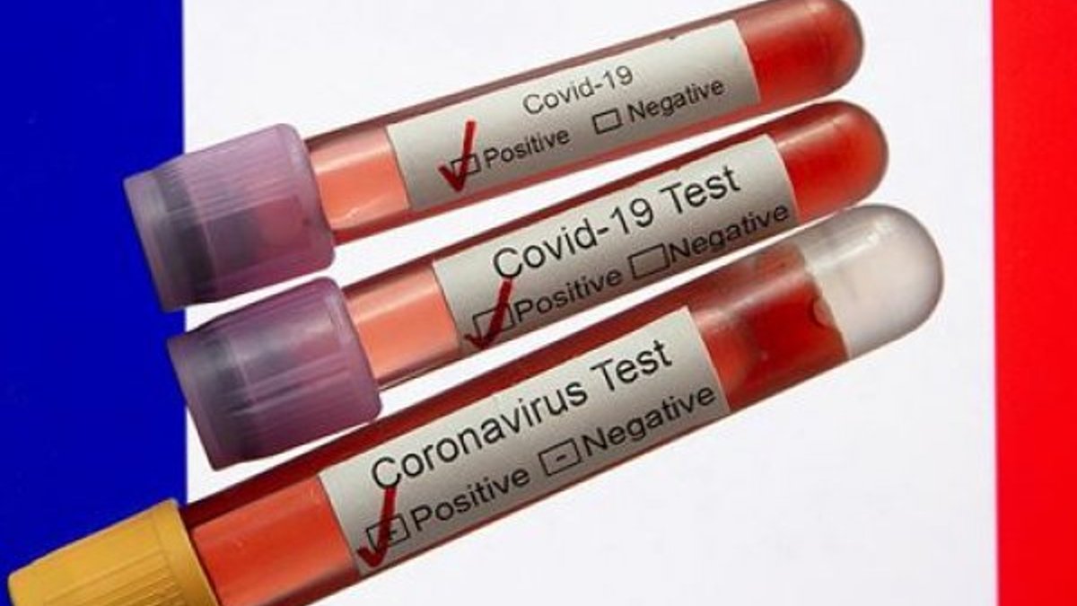 Fransa'da 263 kişi daha koronavirüs nedeniyle hayatını kaybetti