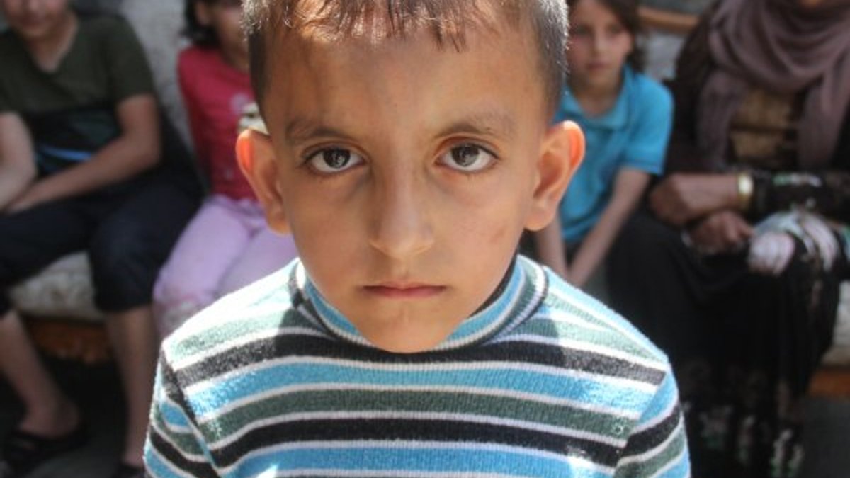 Kalbi delik olan Suriyeli Tarık yardım bekliyor