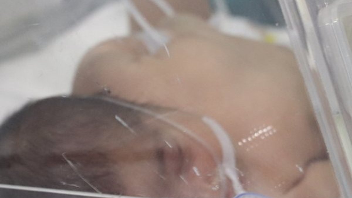 17 günlük bebek ambulans uçakla Ankara'ya gönderildi