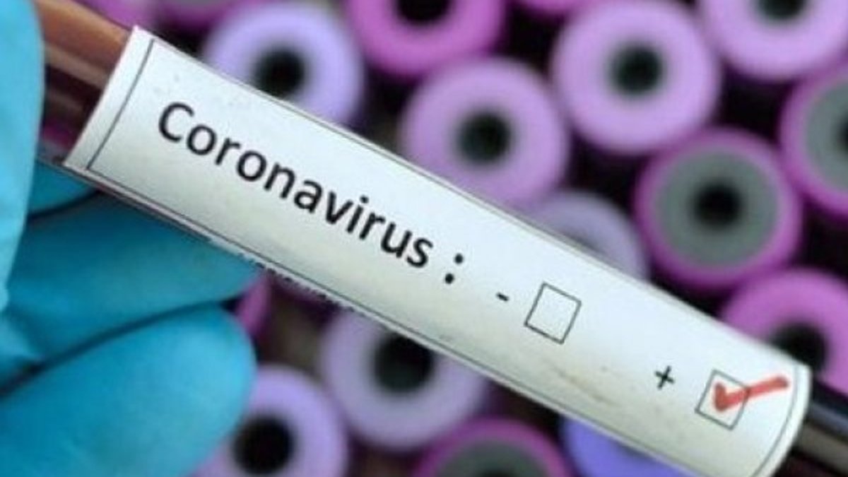 Diyarbakır'da 17 işçide koronavirüs çıktı