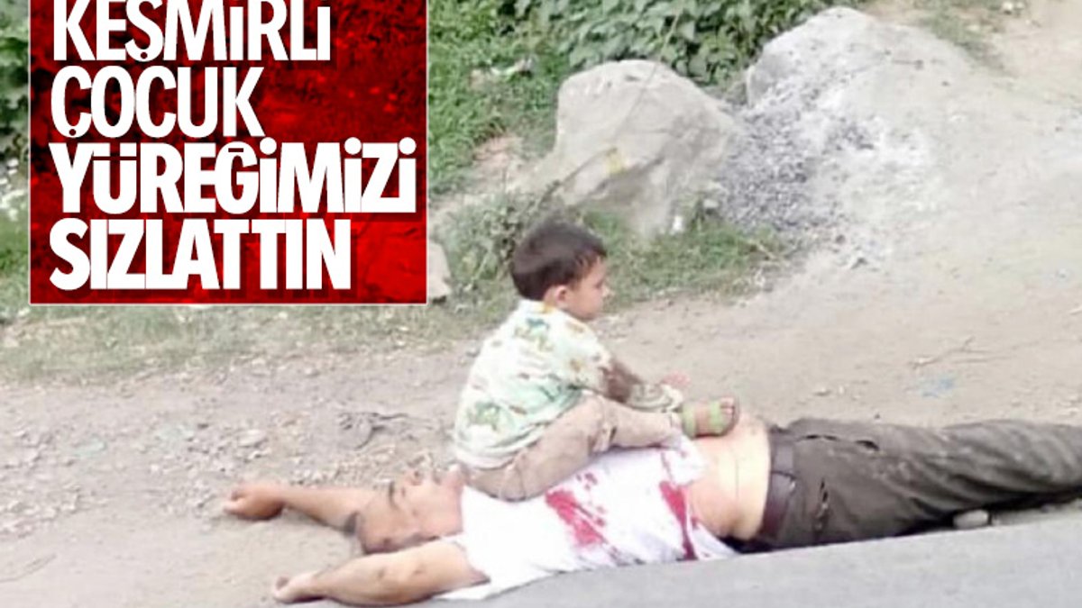 Keşmir'de, 3 yaşındaki çocuğun fotoğrafı infial yarattı