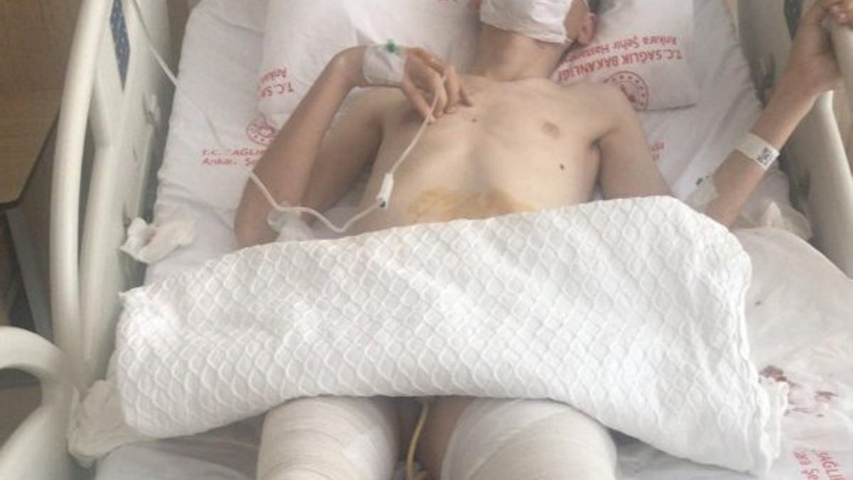 Ankara'da engelli genci döven şahıs yakalandı