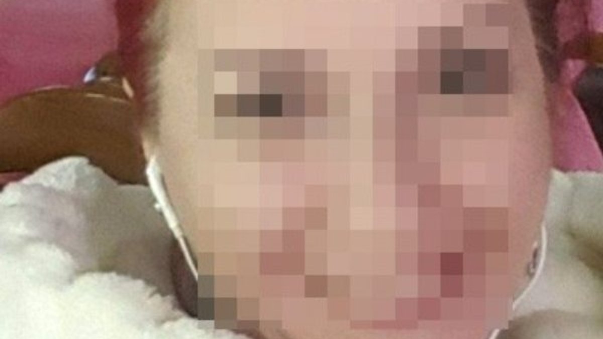 Eskişehir'de sevgilisine kezzap attı: 8 yıl 12 ay hapis