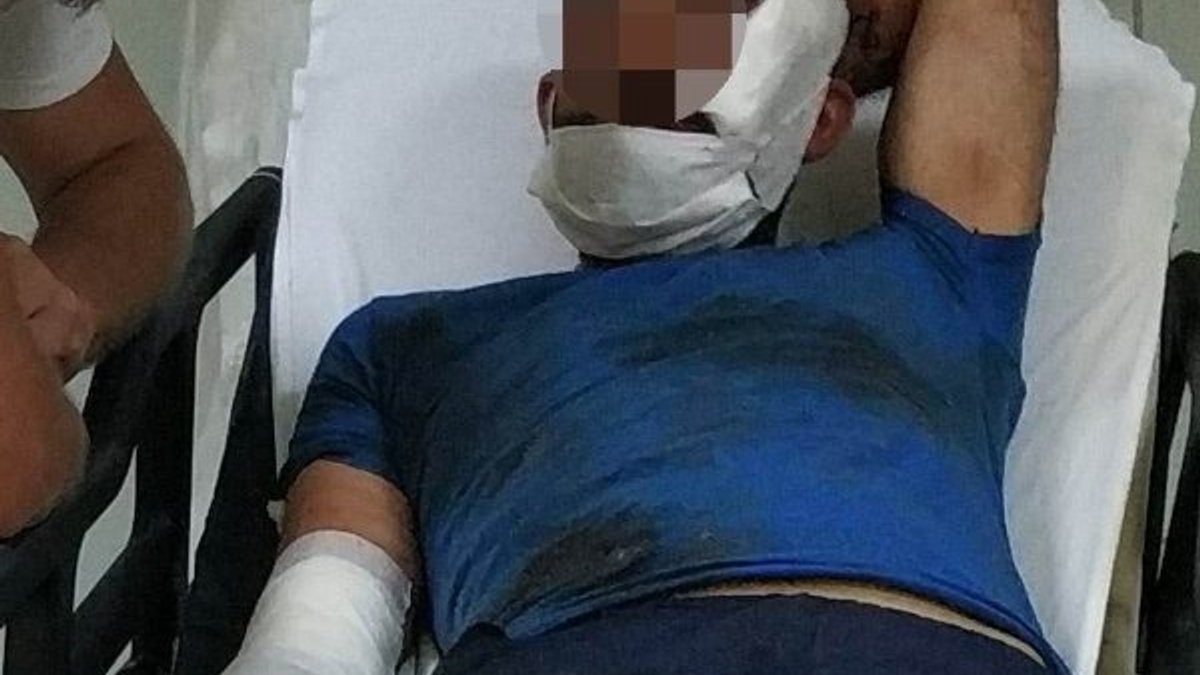 Samsun'da genç kadın kocasını bıçakla yaraladı
