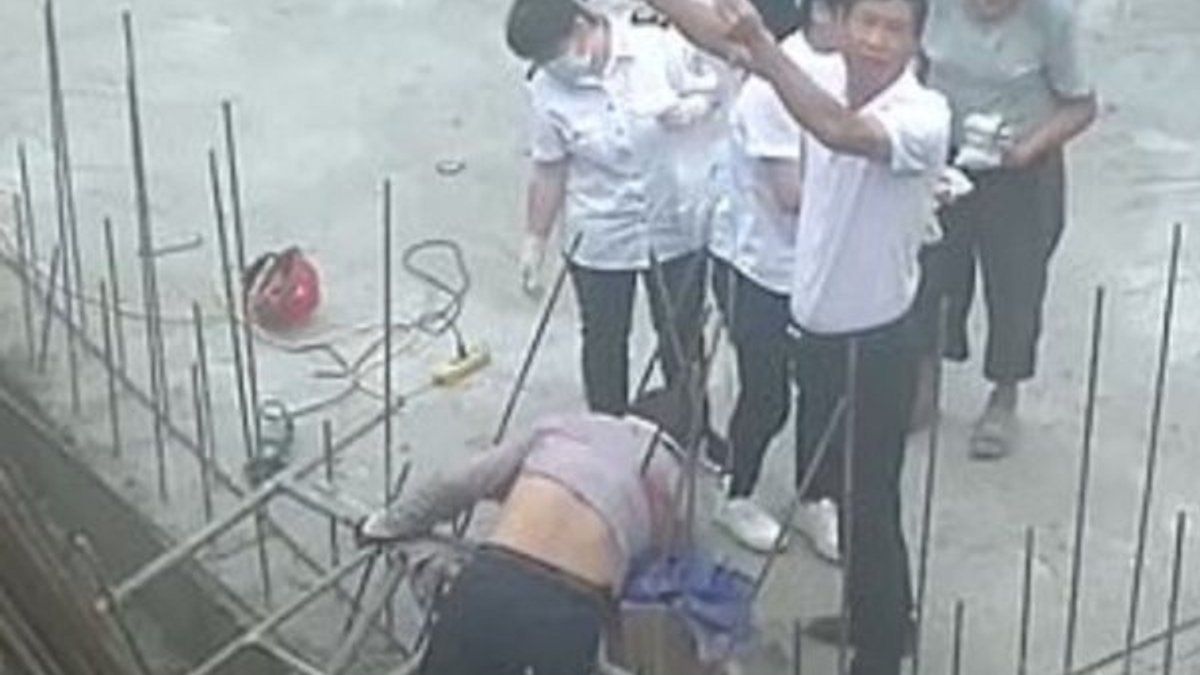 Çin'de demir saplanan inşaat işçisi ölümden döndü