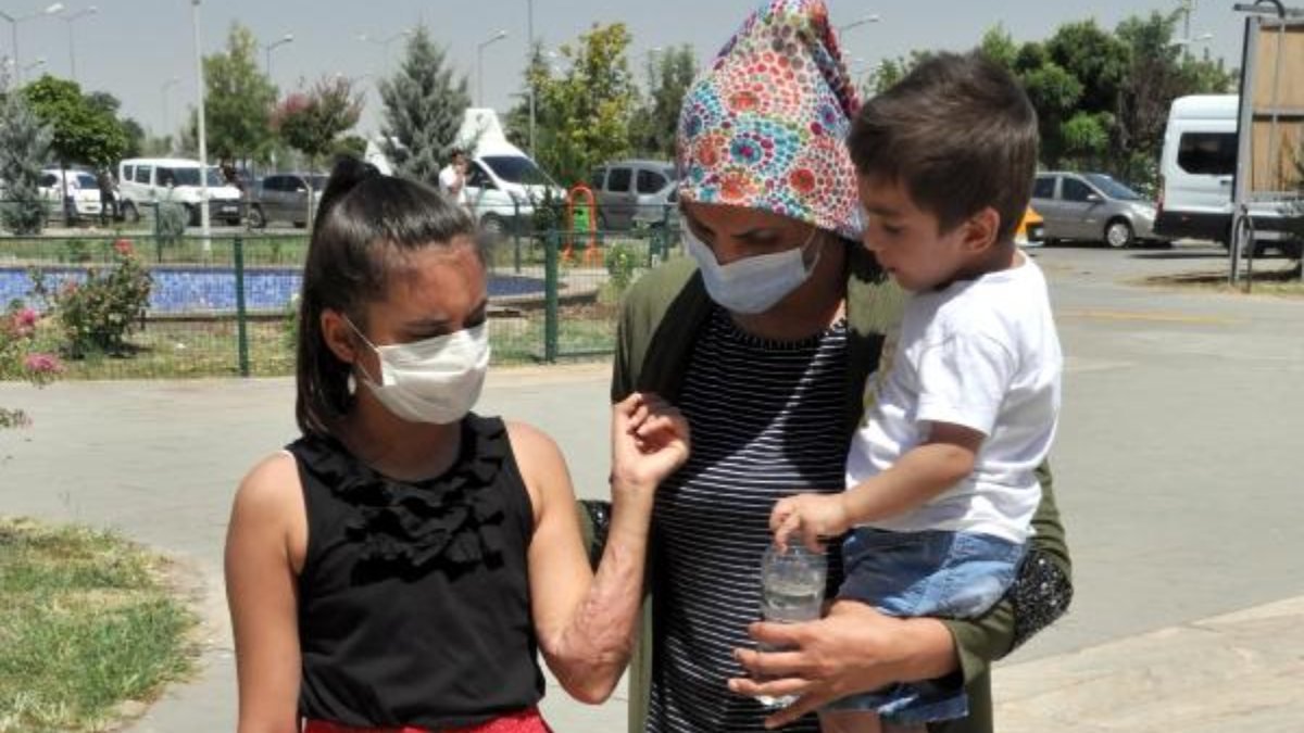 Diyarbakır'da üzerine kazan devrilen Zeynep yardım bekliyor